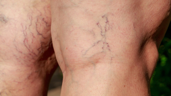 如何才能瘦腿?瘦腿方法背后的几大传闻