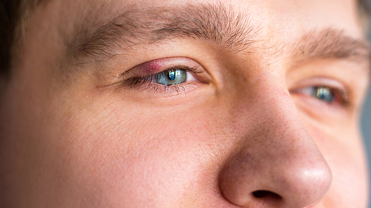 手机对眼睛的危害有多大图片  智能手机对眼睛的危害有多大