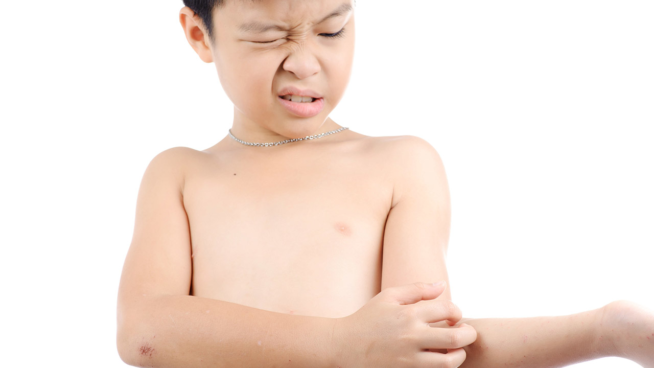 手足口病如何正确护理？手足口病怎么正确护理